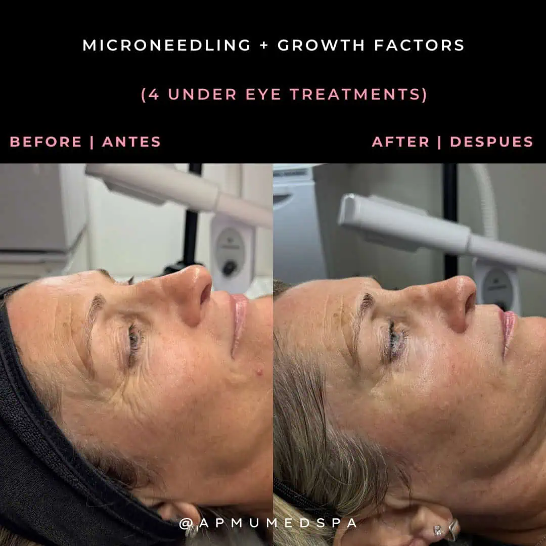 Brown Customer before and after