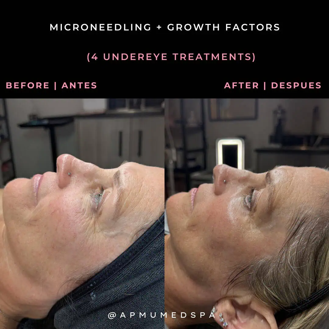 Brown Customer before and after