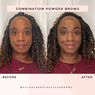 Combination Powder Brows Before and After by APMU Med Spa