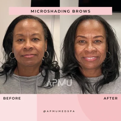 Microshading Brows | APMU Med Spa in Marietta GA