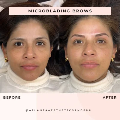 Microblading Brows Before and After by APMU Med Spa