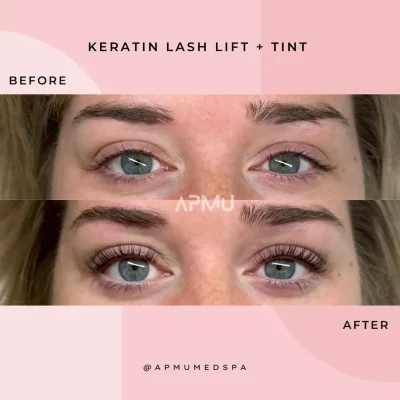 Keratin Lash Lift + Tint Before and after | APMU Med Spa
