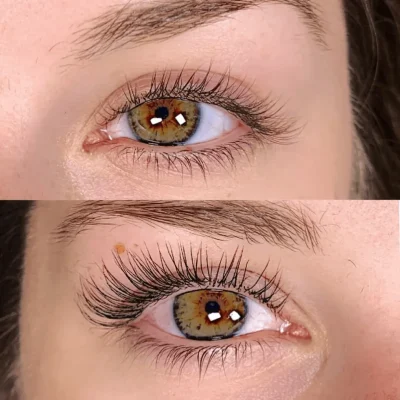 Lash Before and After D | APMU Med Spa in Marietta GA