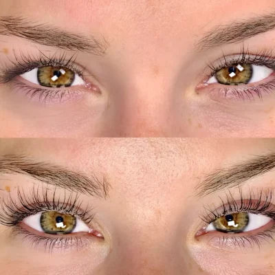 NON-PERMANENT BROWS B IN APMU