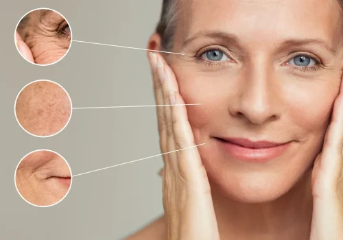 RejuvapenMicroneedling b in Marietta GA
