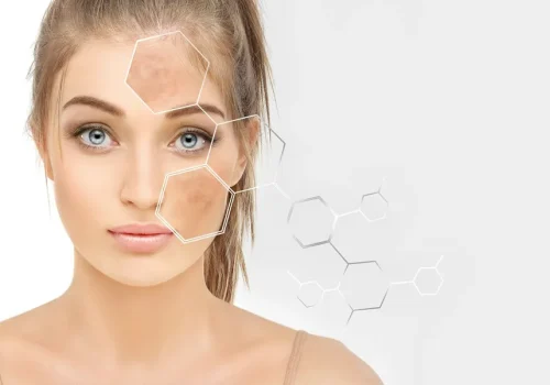 Medium depth chemical peels in Marietta GA by APMU Med Spa